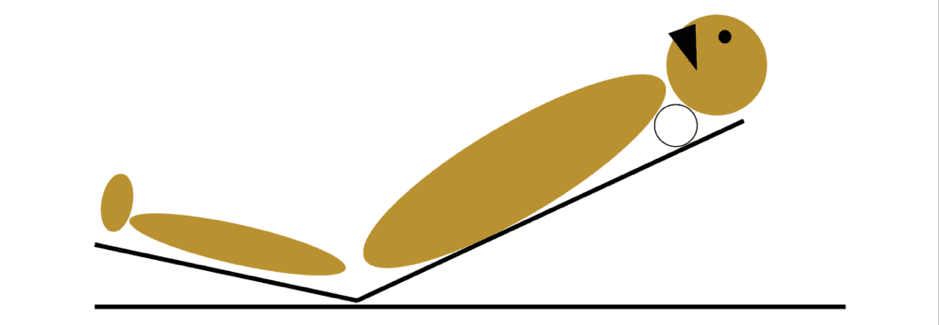 Intubation Ramping